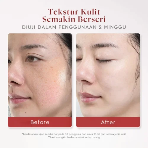 Glad2glow Aha Bha Pha Serum Intensive Peeling Solution Essence Glowing Skin Brightening Dark Spot Acne-pron Blackhead