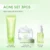Glad2Glow Acne Treament Centella Salicylic Acid Power Clear Barrier Anti Acne Moisturizer Cream Facial Serum Cleanser