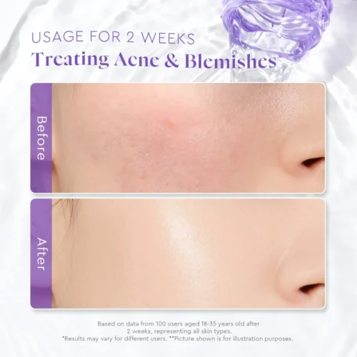 Glad2Glow Blackberry Aha Bha Pha Daily Glycolic Acid Exfoliating Toner Skincare Glowing Brightening Toner Essence 80ml