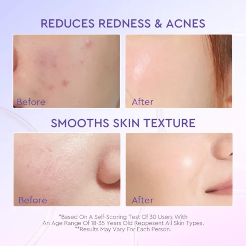 Glad2Glow Blueberry Repair Ceramide Moisturizer （30g）Skincare Day Cream Night Cream Skin Barrier Facial Acne Moisturizer
