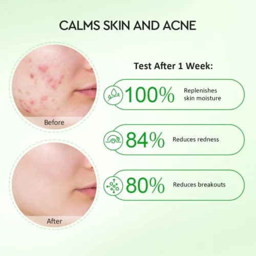 Glad2Glow Centella Allantoin Soothing Moisturizer Gel Repair Skin Barrier Oil-Control Hydrating Cream (55g/30g)