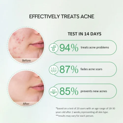 Glad2Glow Centella Salicylic Acid Power Clear Acne Serum 17ml Acne Treatment Medication Prevent the Growth of Jerawat