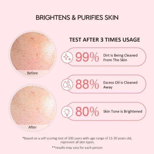 【BUY 1 FREE 1 】Glad2Glow Pomegranate Niacinamide Brightening Clay Mask+ Volcano Clay Mask Masker Wajah Face Cleansing