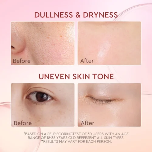 Glad2Glow Pmomegranate Niacinamide Brightening Moisturizer Whitening Glowing Gel Moisture Day Night Face Cream(30g)